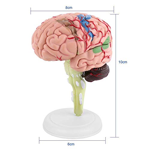 Modelo Anatómico del Cerebro Humano Científico Anatomía Desmontado Herramienta de Enseñanza Médica Cerebro Arterias Laboratorio escolar Modelo de Estudio Equipo