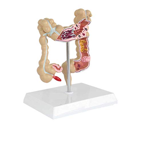 Anatomical Model Life Size Human Colon Large Intestine Rectum Pathology Anatomy Model for Hospitals Clinics