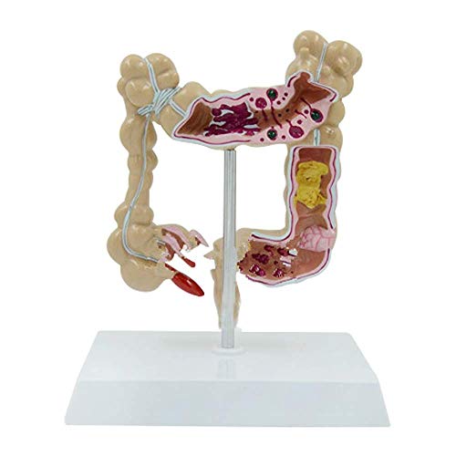 Anatomical Model Life Size Human Colon Large Intestine Rectum Pathology Anatomy Model for Hospitals Clinics